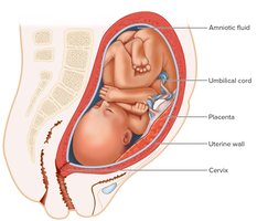 Full-term fetus positioned with head near the cervix