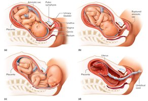 Stages in birth