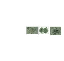 Oocyte with sperm, two-cell stage, morula