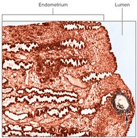 Blastocyst implanting in endometrium