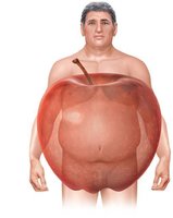 Metabolic syndrome risk factors