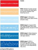 Progression of sleep stages throughout the night