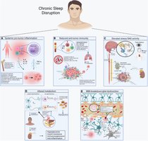 Systemic effects of chronic sleep disruption