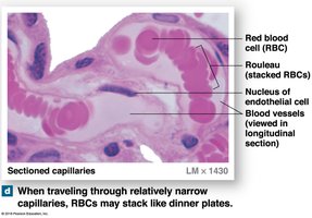 RBCs stacking in capillaries (rouleaux)