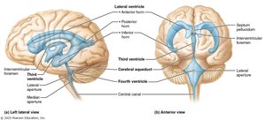 Diagram of brain ventricles