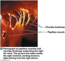 Papillary muscles and chordae tendineae supporting the AV valve