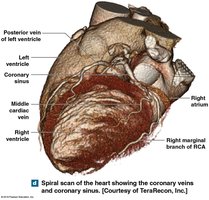 Coronary vessels on posterior of heart