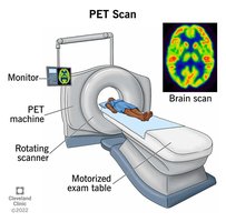 PET scan using radioisotopes