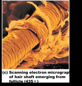 Scanning electron micrograph of hair shaft
