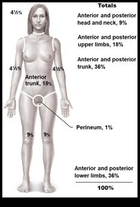 Rule of Nines for estimating burn extent