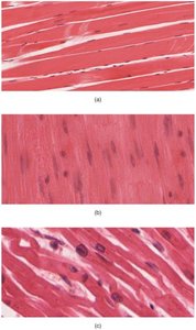 Histological comparison of skeletal, cardiac, and smooth muscle tissue