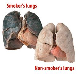Healthy lung vs. smoker's lung with carcinoma