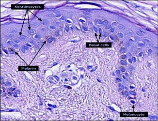 Histological section showing keratinocytes, melanocytes, and basal cells