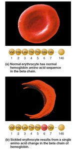 Sickle-cell anemia: normal vs sickled erythrocyte