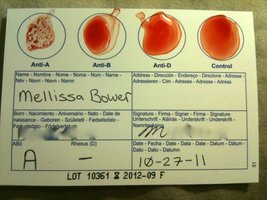 Blood typing card with agglutination results