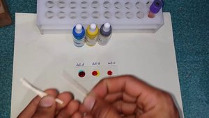 Blood typing test procedure