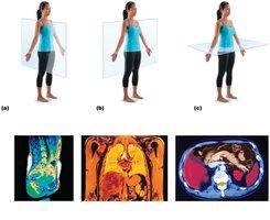 Body planes: sagittal, frontal, transverse