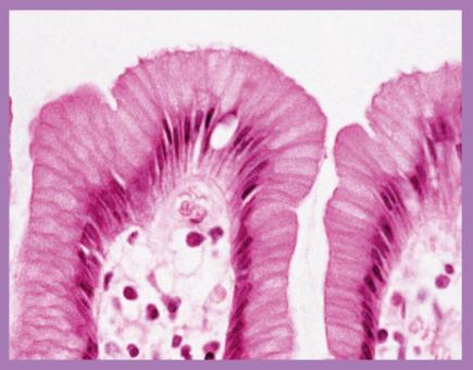 Stratified squamous epithelium structure and function