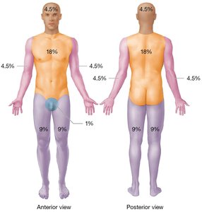 Rule of nines for burn assessment
