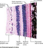 Photomicrograph of retina