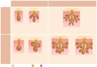 Types of multicellular exocrine glands