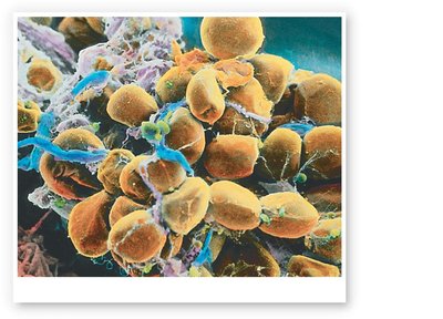 SEM of adipocytes in subcutaneous layer