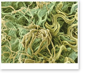SEM of collagen and elastic fibers in reticular layer