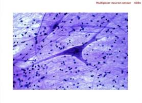 Multipolar neuron smear