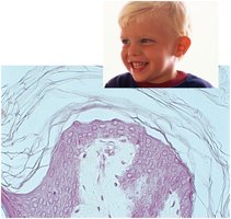 Histological section of light skin