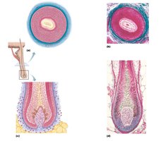 Longitudinal view of hair bulb and follicle