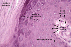 Histological image showing layers of the epidermis: stratum corneum, granulosum, spinosum, basale