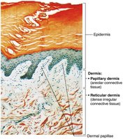 Histological section showing epidermis, papillary dermis, and reticular dermis