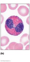 Eosinophil with bilobed nucleus and red granules