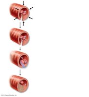 Events of hemostasis: vascular spasm, platelet plug, coagulation