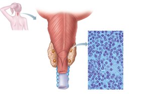 Parathyroid gland anatomy and histology
