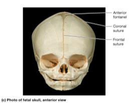 Fetal skull, anterior view
