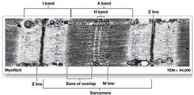 Sarcomere structure, electron micrograph