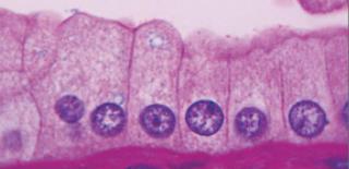 Simple columnar epithelium of the intestines