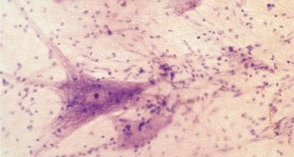 Cardiac muscle tissue of the heart