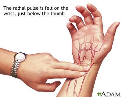 Palpation of the radial pulse at the wrist