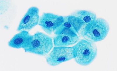 Normal urothelial cells under a microscope