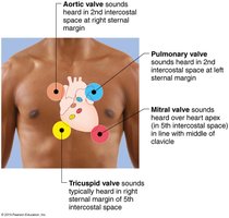 Auscultation sites for heart valves