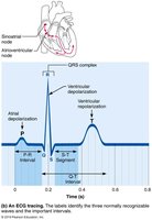 An ECG tracing with labeled waves and intervals