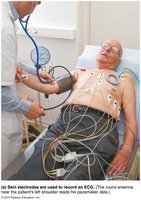 Skin electrodes are used to record an ECG
