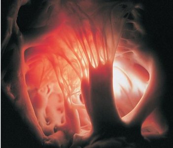 Diagram of heart valves and their function