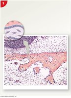 Intramembranous ossification process