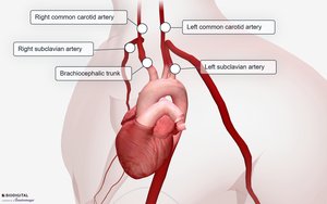 Aorta and its major branches