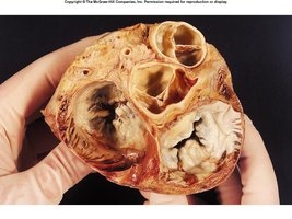 Skeleton of the heart and valve attachments