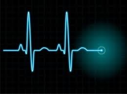 ECG tracing with labeled waves