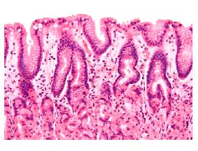 Simple columnar epithelium micrograph